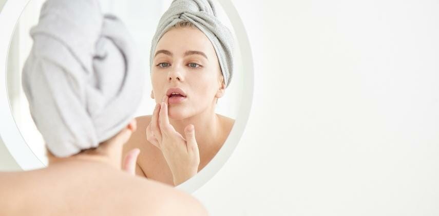 Hormonal Acne
